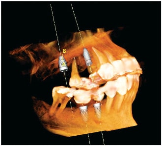 advanced-dental-technology