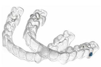 Invisalign® Bay Area Invisalign® Bay Area