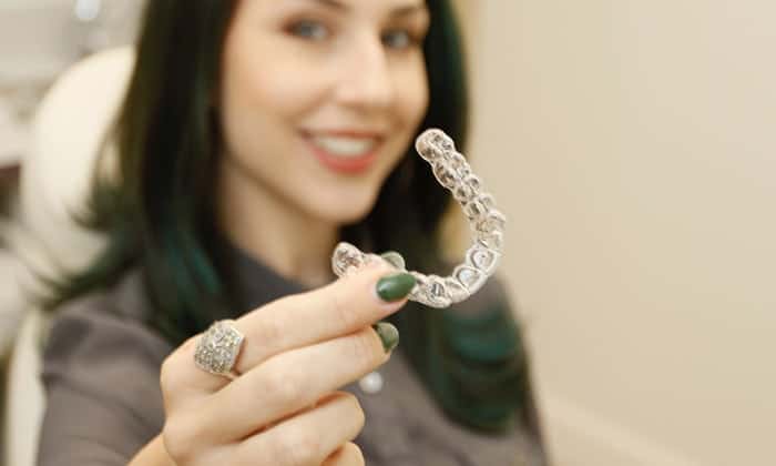 Invisalign® San Jose CA Invisalign® San Jose CA