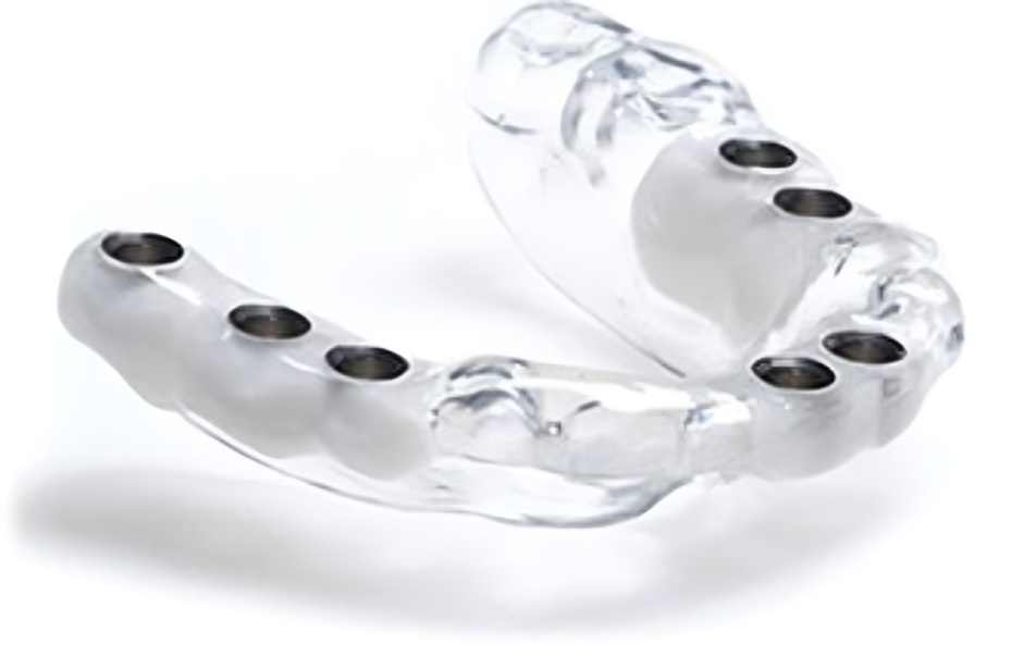 Implant Placement Bay Area