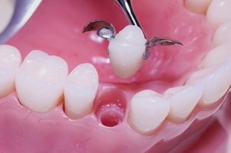 Maryland Bridge Bay Area