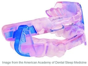 oral-appliance-2