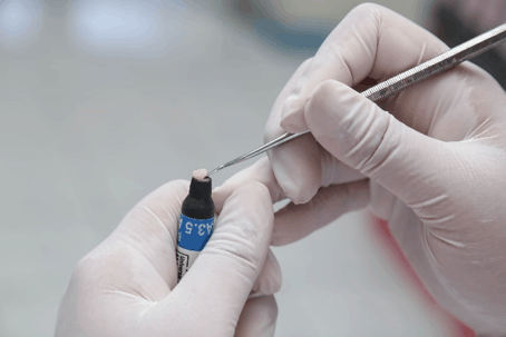 Tooth-Colored Fillings San Jose CA Tooth-Colored Fillings San Jose CA